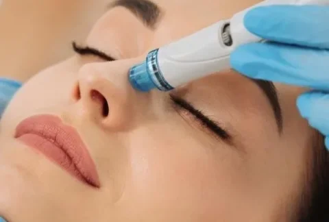 Hydra facial (Aqua peeling)