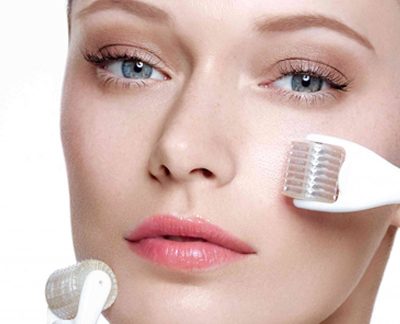Microneedling